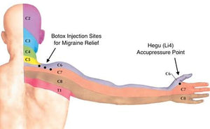 Acupressure Clip (3 Pack) - Baldoni Neuromodulation